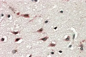IHC-P analysis of human cerebral cortex using GTX89566 DYX1C1 (Isoform a) antibody, C-term. Antigen retrieval : citrate buffer pH 6 Dilution : 5microg/ml