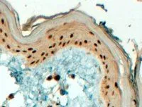 IHC-P analysis of human skin using GTX89567 AP2 gamma antibody, C-term. Antigen retrieval : Tris/EDTA buffer pH 9 Dilution : 4microg/ml IHC-P analysis of human skin using GTX89567 AP2 gamma antibody, C-term. Antigen retrieval : Tris/EDTA buffer pH 9 Dilution : 4microg/ml