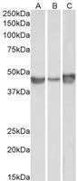 WB analysis of A549 (A), HepG2 (B) and HeLa (C) lysates using GTX89568 PAI-1 antibody, Internal. Dilution : 0.1microg/ml Loading : 35microg protein in RIPA buffer WB analysis of A549 (A), HepG2 (B) and HeLa (C) lysates using GTX89568 PAI-1 antibody, Internal. Dilution : 0.1microg/ml Loading : 35microg protein in RIPA buffer