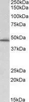 WB analysis of human liver lysate using GTX89568 PAI-1 antibody, Internal. Dilution : 0.3microg/ml Loading : 35microg protein in RIPA buffer