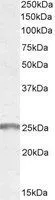 WB analysis of human muscle lysate using GTX89573 Synaptogyrin 2 antibody, Internal. Dilution : 0.3microg/ml Loading : 35microg protein in RIPA buffer WB analysis of human muscle lysate using GTX89573 Synaptogyrin 2 antibody, Internal. Dilution : 0.3microg/ml Loading : 35microg protein in RIPA buffer