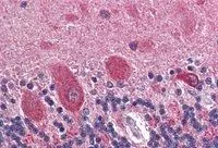 IHC-P analysis of human cerebellum using GTX89575 GAD65 antibody, Internal. Antigen retrieval : citrate buffer pH 6 Dilution : 2.5microg/ml