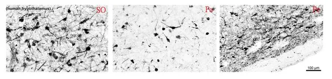 IHC-Fr analysis of PFA-perfused human hypothalamic supraoptic (SO), paraventricular (Pa) and periventricular (Pe) nuclei using GTX89578 Tyrosine Hydroxylase antibody, C-term. Antigen retrieval : citrate buffer pH 6 at 80C for 30min Dilution : 0.1microg/ml IHC-Fr analysis of PFA-perfused human hypothalamic supraoptic (SO), paraventricular (Pa) and periventricular (Pe) nuclei using GTX89578 Tyrosine Hydroxylase antibody, C-term. Antigen retrieval : citrate buffer pH 6 at 80C for 30min Dilution : 0.1microg/ml