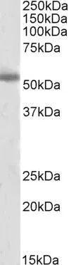 WB analysis of human cerebral cortex lysate using GTX89578 Tyrosine Hydroxylase antibody, C-term. Dilution : 2microg/ml Loading : 35microg protein in RIPA buffer