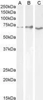 WB analysis of Daudi (A), HeLa (B) and Jurkat (C) cell lysate using GTX89580 AChE antibody, C-term. Dilution : 0.3microg/ml Loading : 35microg protein in RIPA buffer WB analysis of Daudi (A), HeLa (B) and Jurkat (C) cell lysate using GTX89580 AChE antibody, C-term. Dilution : 0.3microg/ml Loading : 35microg protein in RIPA buffer