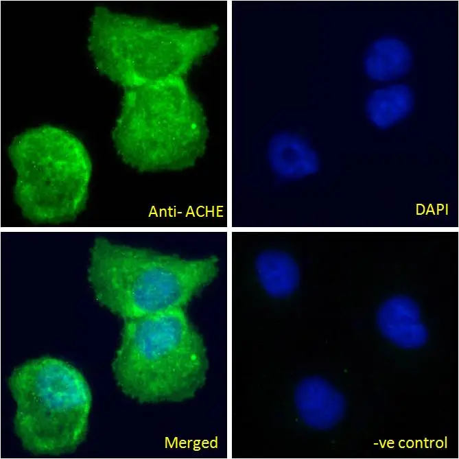 ICC/IF analysis of PFA fixed U2OS cells using GTX89580 AChE antibody, C-term. Green : Primary antibody Blue : DAPI Permeabilization : 0.15% Triton Dilution : 10microg/ml