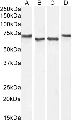 WB analysis of HepG2 (A), Daudi (B) and HeLa (C) and Jurkat (D) cell lysate (35microg protein in RIPA buffer) using GTX89580 AChE antibody, C-term. Dilution : 1microg/ml (HepG2 and Daudi) and 0.3microg/ml (HeLa and Jurkat)