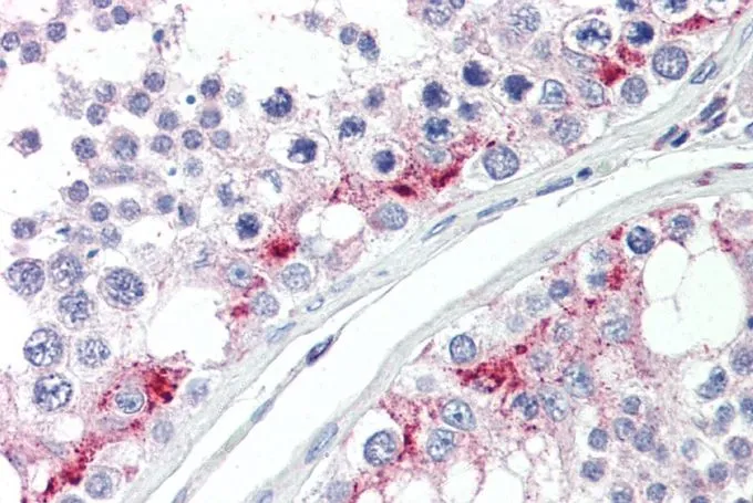 IHC-P analysis of human testis using GTX89582 ZDHHC17 antibody, C-term. Antigen retrieval : citrate buffer pH 6 Dilution : 5microg/ml