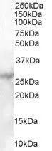 WB analysis of human heart lysate using GTX89586 MBL-C antibody, C-term. Dilution : 1microg/ml Loading : 35microg protein in RIPA buffer WB analysis of human heart lysate using GTX89586 MBL-C antibody, C-term. Dilution : 1microg/ml Loading : 35microg protein in RIPA buffer