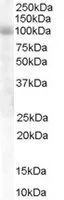 WB analysis of human lung lysate using GTX89591 HPS6 antibody, Internal. Dilution : 1microg/ml Loading : 30microg protein in RIPA buffer WB analysis of human lung lysate using GTX89591 HPS6 antibody, Internal. Dilution : 1microg/ml Loading : 30microg protein in RIPA buffer