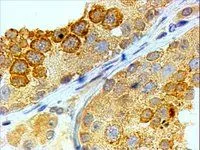 IHC-P analysis of human testis using GTX89597 BOLL antibody, C-term. Antigen retrieval : citrate buffer pH 6 Dilution : 4microg/ml IHC-P analysis of human testis using GTX89597 BOLL antibody, C-term. Antigen retrieval : citrate buffer pH 6 Dilution : 4microg/ml