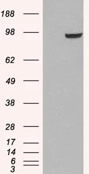 WB analysis of HEK293 overexpressing PDE5A (mock transfection in first lane) using GTX89598 PDE5A antibody, C-term.