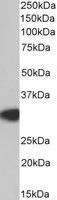 WB analysis of human thymus lysate using GTX89605 MyD88 antibody, Internal. Dilution : 0.2microg/ml Loading : 35microg protein in RIPA buffer WB analysis of human thymus lysate using GTX89605 MyD88 antibody, Internal. Dilution : 0.2microg/ml Loading : 35microg protein in RIPA buffer