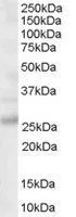 WB analysis of human brain lysate using GTX89606 MOG antibody, C-term. Dilution : 0.03microg/ml Loading : 30microg protein in RIPA buffer WB analysis of human brain lysate using GTX89606 MOG antibody, C-term. Dilution : 0.03microg/ml Loading : 30microg protein in RIPA buffer