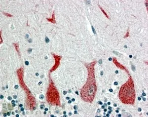 IHC-P analysis of human cerebellum using GTX89607 Retinoic Acid Receptor alpha antibody, C-term. Antigen retrieval : citrate buffer pH 6 Dilution : 4microg/ml