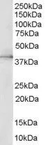 WB analysis of HepG2 lysate using GTX89615 ERK2 antibody, Internal. Dilution : 0.5microg/ml Loading : 35microg protein in RIPA buffer