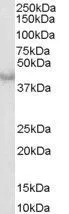 WB analysis of human heart lysate using GTX89618 Caspase 4 antibody, Internal. Dilution : 0.3microg/ml Loading : 35microg protein in RIPA buffer