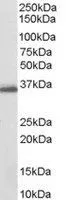 WB analysis of human breast lysate using GTX89620 AKR1C3 antibody, C-term. Dilution : 0.03microg/ml Loading : 35microg protein in RIPA buffer WB analysis of human breast lysate using GTX89620 AKR1C3 antibody, C-term. Dilution : 0.03microg/ml Loading : 35microg protein in RIPA buffer