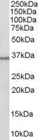 WB analysis of human liver lysate using GTX89627 HSD11B1 antibody, C-term. Dilution : 0.3microg/ml Loading : 35microg protein in RIPA buffer WB analysis of human liver lysate using GTX89627 HSD11B1 antibody, C-term. Dilution : 0.3microg/ml Loading : 35microg protein in RIPA buffer