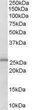 WB analysis of human lung lysate using GTX89628 GSTM1 / GSTM2 antibody, C-term. Dilution : 0.3microg/ml Loading : 35microg protein in RIPA buffer WB analysis of human lung lysate using GTX89628 GSTM1 / GSTM2 antibody, C-term. Dilution : 0.3microg/ml Loading : 35microg protein in RIPA buffer