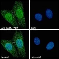 ICC/IF analysis of PFA fixed U2OS cells using GTX89631 PAD4 antibody, N-term. Green : Primary antibody Blue : DAPI VE-control : Unimmunized goat IgG (10microg/ml) Permeabilization : 0.15% Triton Dilution : 10microg/ml ICC/IF analysis of PFA fixed U2OS cells using GTX89631 PAD4 antibody, N-term. Green : Primary antibody Blue : DAPI VE-control : Unimmunized goat IgG (10microg/ml) Permeabilization : 0.15% Triton Dilution : 10microg/ml