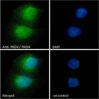 ICC/IF analysis of PFA fixed HeLa cells using GTX89631 PAD4 antibody, N-term. Green : Primary antibody Blue : DAPI VE-control : Unimmunized goat IgG (10microg/ml) Permeabilization : 0.15% Triton Dilution : 10microg/ml