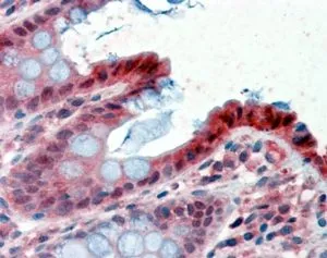 IHC-P analysis of human colon using GTX89634 15-PGDH antibody, C-term. Antigen retrieval : citrate buffer pH 6 Dilution : 2.5microg/ml