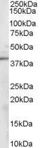 WB analysis of mouse kidney lysate using GTX89635 Sorbitol Dehydrogenase antibody, C-term. Dilution : 0.1microg/ml Loading : 35microg protein in RIPA buffer WB analysis of mouse kidney lysate using GTX89635 Sorbitol Dehydrogenase antibody, C-term. Dilution : 0.1microg/ml Loading : 35microg protein in RIPA buffer