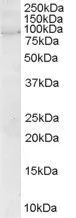 WB analysis of human brain lysate using GTX89645 ARHGEF4 antibody, N-term. Dilution : 2microg/ml Loading : 35microg protein in RIPA buffer WB analysis of human brain lysate using GTX89645 ARHGEF4 antibody, N-term. Dilution : 2microg/ml Loading : 35microg protein in RIPA buffer