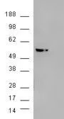 WB analysis of HEK293 overexpressing AKT3 (mock transfection in second lane) using GTX89647 AKT3 antibody, Internal.