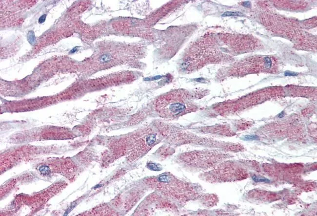 IHC-P analysis of human heart using GTX89647 AKT3 antibody, Internal. Antigen retrieval : citrate buffer pH 6 Dilution : 5microg/ml