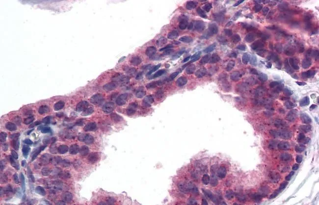 IHC-P analysis of human prostate using GTX89647 AKT3 antibody, Internal. Antigen retrieval : citrate buffer pH 6 Dilution : 5microg/ml
