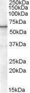 WB analysis of HeLa nuclear lysate using GTX89652 Retinoid X Receptor alpha antibody, Internal. Dilution : 0.3microg/ml Loading : 35microg protein in RIPA buffer WB analysis of HeLa nuclear lysate using GTX89652 Retinoid X Receptor alpha antibody, Internal. Dilution : 0.3microg/ml Loading : 35microg protein in RIPA buffer