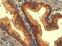 IHC-P analysis of human prostate using GTX89659 MRP4 antibody, C-term. Antigen retrieval : Tris/EDTA buffer pH 9 Dilution : 4microg/ml IHC-P analysis of human prostate using GTX89659 MRP4 antibody, C-term. Antigen retrieval : Tris/EDTA buffer pH 9 Dilution : 4microg/ml