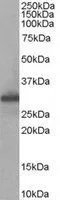 WB analysis of human muscle lysate using GTX89663 FHL1 antibody, Internal. Dilution : 0.05microg/ml Loading : 35microg protein in RIPA buffer WB analysis of human muscle lysate using GTX89663 FHL1 antibody, Internal. Dilution : 0.05microg/ml Loading : 35microg protein in RIPA buffer