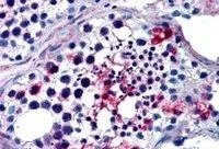 IHC-P analysis of human testis using GTX89663 FHL1 antibody, Internal. Antigen retrieval : citrate buffer pH 6 Dilution : 2.5microg/ml