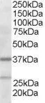 WB analysis of human liver lysate using GTX89664 p41-ARCb antibody, N-term. Dilution : 2microg/ml Loading : 35microg protein in RIPA buffer WB analysis of human liver lysate using GTX89664 p41-ARCb antibody, N-term. Dilution : 2microg/ml Loading : 35microg protein in RIPA buffer