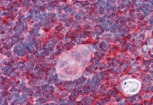 IHC-P analysis of human thymus using GTX89664 p41-ARCb antibody, N-term. Antigen retrieval : citrate buffer pH 6 Dilution : 5microg/ml