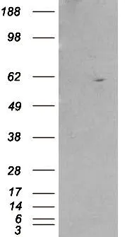 WB analysis of HEK293 overexpressing Retinoid X Receptor beta (mock transfection in first lane) using GTX89670 Retinoid X Receptor beta antibody, Internal.