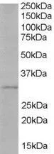 WB analysis of human liver lysate using GTX89676 TIRAP / Mal (Isoform b) antibody, C-term. Dilution : 1microg/ml Loading : 35microg protein in RIPA buffer WB analysis of human liver lysate using GTX89676 TIRAP / Mal (Isoform b) antibody, C-term. Dilution : 1microg/ml Loading : 35microg protein in RIPA buffer