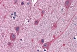 IHC-P analysis of human cortex using GTX89679 STAP2 antibody, C-term. Antigen retrieval : citrate buffer pH 6 Dilution : 3.8microg/ml