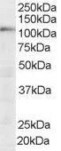 WB analysis of HeLa lysate using GTX89682 SART1 antibody, N-term. Dilution : 0.03microg/ml Loading : 35microg protein in RIPA buffer WB analysis of HeLa lysate using GTX89682 SART1 antibody, N-term. Dilution : 0.03microg/ml Loading : 35microg protein in RIPA buffer