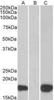 WB analysis of HEK293 overexpressing human PHLDA3 with C-terminal MYC tag using GTX89684 PHLDA3 antibody, C-term. Lane A : primary antibody Lane B : Mock-transfected HEK293 probed with primary antibody Lane C : Tag antibody Dilution : 1microg/ml Loading : 10microg protein in RIPA buffer WB analysis of HEK293 overexpressing human PHLDA3 with C-terminal MYC tag using GTX89684 PHLDA3 antibody, C-term. Lane A : primary antibody Lane B : Mock-transfected HEK293 probed with primary antibody Lane C : Tag antibody Dilution : 1microg/ml Loading : 10microg protein in RIPA buffer