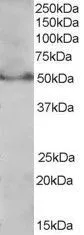 WB analysis of Molt-4 cell lysate using GTX89687 PPAR delta (Isoform 1) antibody, C-term. Dilution : 0.3microg/ml Loading : 35microg protein in RIPA buffer WB analysis of Molt-4 cell lysate using GTX89687 PPAR delta (Isoform 1) antibody, C-term. Dilution : 0.3microg/ml Loading : 35microg protein in RIPA buffer