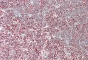 IHC-P analysis of human thymus using GTX89690 CrkL antibody, C-term. Antigen retrieval : citrate buffer pH 6 Dilution : 3.8microg/ml
