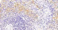 IHC-P analysis of human spleen using GTX89695 VAV3 antibody, Internal. Antigen retrieval : citrate buffer pH 6 Dilution : 5microg/ml