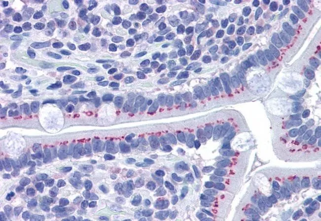 IHC-P analysis of human small intestine using GTX89715 GOLPH2 antibody, C-term. Antigen retrieval : citrate buffer pH 6 Dilution : 3.75microg/ml