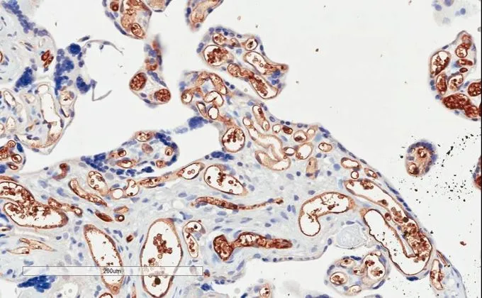 IHC-P analysis of human placenta using GTX89716 PI3 kinase C2 alpha antibody, C-term. Antigen retrieval : citrate buffer pH 6 Dilution : 2microg/ml IHC-P analysis of human placenta using GTX89716 PI3 kinase C2 alpha antibody, C-term. Antigen retrieval : citrate buffer pH 6 Dilution : 2microg/ml