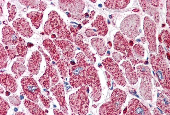 IHC-P analysis of human heart using GTX89716 PI3 kinase C2 alpha antibody, C-term. Antigen retrieval : citrate buffer pH 6 Dilution : 5microg/ml