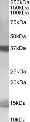 WB analysis of K562 lysate using GTX89717 Prefoldin 1 antibody, C-term. Dilution : 1microg/ml Loading : 35microg protein in RIPA buffer WB analysis of K562 lysate using GTX89717 Prefoldin 1 antibody, C-term. Dilution : 1microg/ml Loading : 35microg protein in RIPA buffer